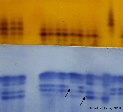 ACP and MDH isozyme patterns on starch gel. Arrows show different patterns.